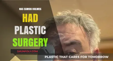 Eamonn Holmes Plastic Surgery Speculations: Fact or Fiction?