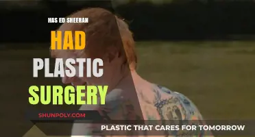 Ed Sheeran's Transformation: Plastic Surgery Rumors Explored and Debunked