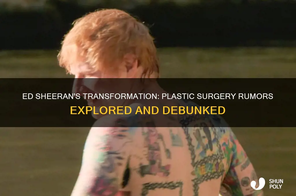 has ed sheeran had plastic surgery