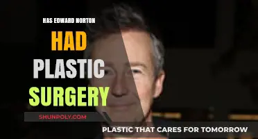 Edward Norton Plastic Surgery: Fact or Fiction? Unveiling the Truth