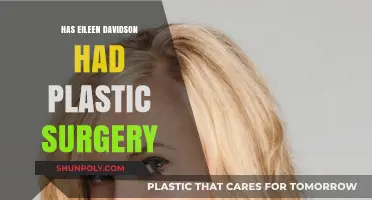 Eileen Davidson's Transformation: Plastic Surgery Speculations and Truths