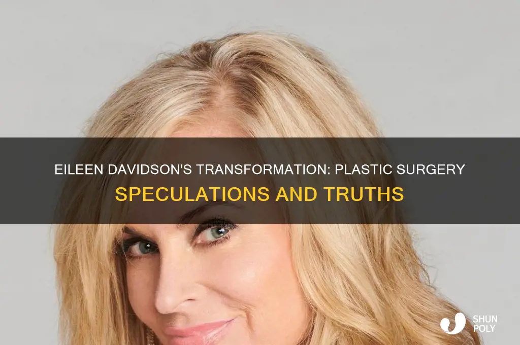 has eileen davidson had plastic surgery