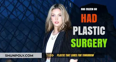 Eileen Gu's Transformation: Plastic Surgery Rumors and Reality Revealed