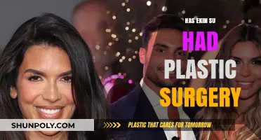 Ekin-Su's Transformation: Unveiling the Truth About Plastic Surgery Rumors