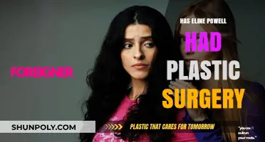 Eline Powell Plastic Surgery: Fact-Checking the Actress' Transformation Rumors