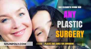 Elisabeth Rohm's Transformation: Plastic Surgery Speculations and Truths