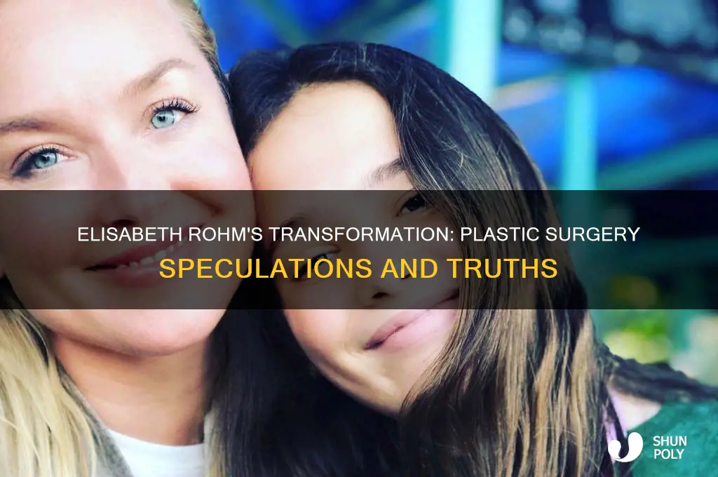 has elisabeth rohm had any plastic surgery