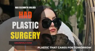 Elizabeth Gillies Plastic Surgery: Fact-Checking Rumors and Speculations