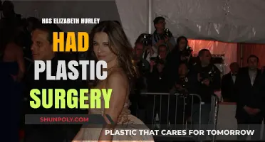 Elizabeth Hurley's Transformation: Plastic Surgery Rumors and Reality Revealed