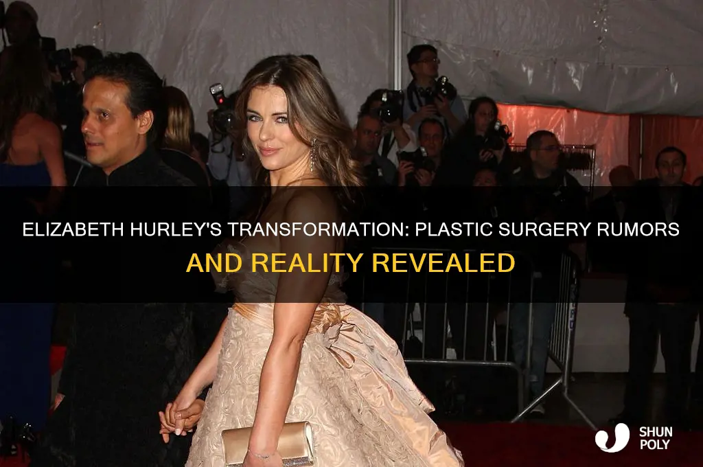 has elizabeth hurley had plastic surgery
