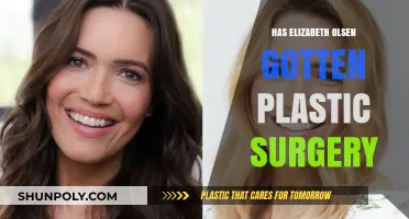 Elizabeth Olsen's Transformation: Plastic Surgery Rumors Explored