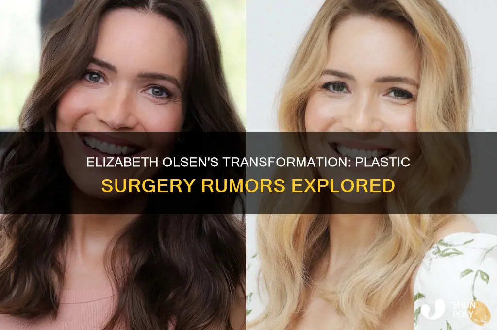has elizabeth olsen gotten plastic surgery