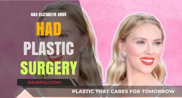 Elizabeth Shue's Transformation: Plastic Surgery Speculations and Truths