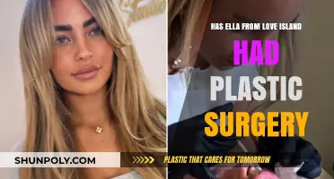 Ella's Transformation: Unveiling the Truth About Her Plastic Surgery Rumors