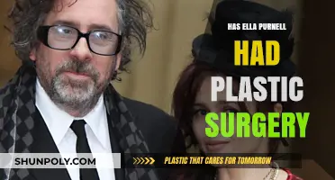 Ella Purnell Plastic Surgery: Fact-Checking the Rumors and Speculations