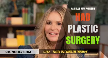 Elle Macpherson's Beauty Secrets: Plastic Surgery or Natural Glow?