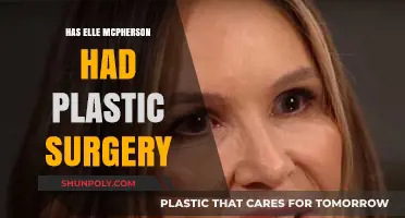 Elle Macpherson's Beauty Secrets: Plastic Surgery Rumors Explored
