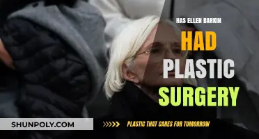 Ellen Barkin's Transformation: Plastic Surgery Speculations and Truths