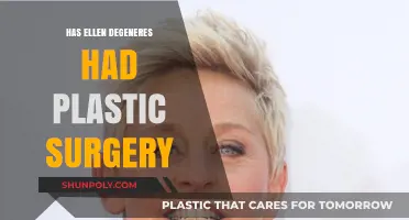 Ellen DeGeneres Plastic Surgery: Fact or Fiction? Uncovering the Truth