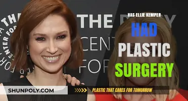 Ellie Kemper's Transformation: Plastic Surgery Rumors Explored and Debunked