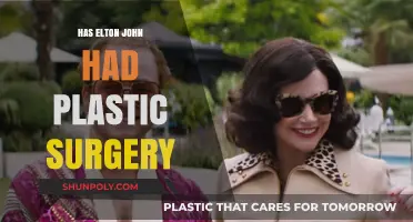 Elton John's Transformation: Unveiling the Truth About Plastic Surgery