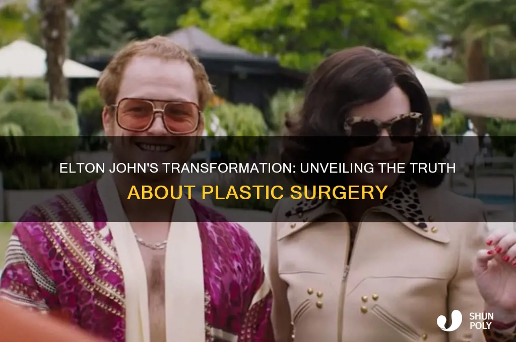 has elton john had plastic surgery