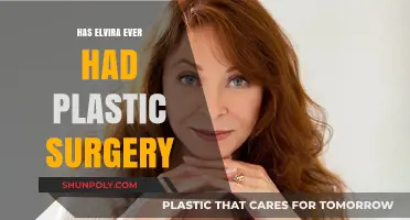 Elvira's Transformation: Plastic Surgery Rumors and Reality Revealed