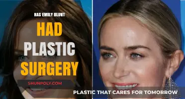 Emily Blunt's Transformation: Plastic Surgery Speculations and Facts Revealed