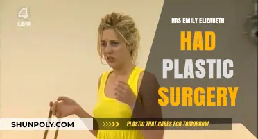 Emily Elizabeth's Transformation: Plastic Surgery Speculations and Truths Revealed