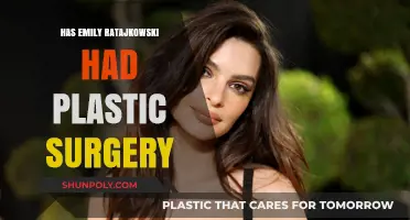 Emily Ratajkowski's Transformation: Plastic Surgery Rumors Explored