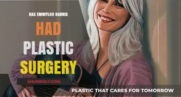 Emmylou Harris Plastic Surgery: Fact-Checking the Rumors and Speculations