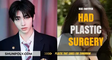 Enhypen Plastic Surgery Rumors: Fact-Checking the K-Pop Group's Transformation