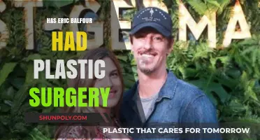 Eric Balfour's Transformation: Plastic Surgery Rumors Explored