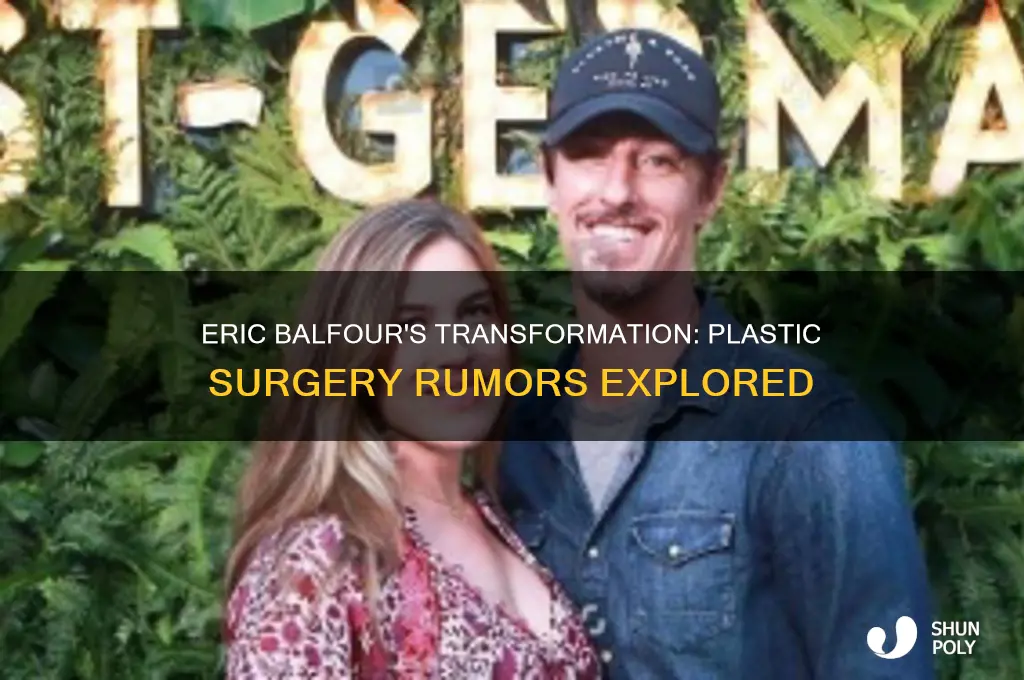 has eric balfour had plastic surgery