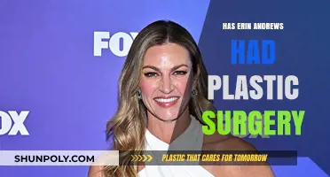 Erin Andrews Plastic Surgery: Fact-Checking Rumors and Speculations
