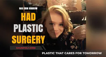Erin Krakow's Transformation: Plastic Surgery Speculations and Facts Revealed
