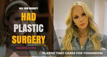 Erin Moriarty Plastic Surgery: Fact-Checking the Rumors and Speculations