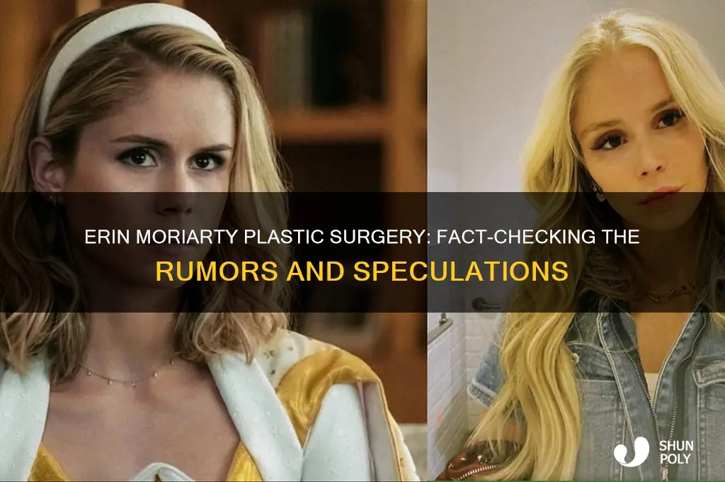 has erin moriaty had plastic surgery