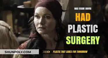 Essie Davis Plastic Surgery: Fact-Checking the Rumors and Speculations