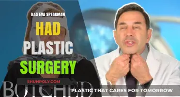 Eva Speakman Plastic Surgery: Fact-Checking the Rumors and Speculations
