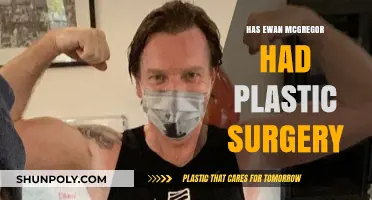 Ewan McGregor Plastic Surgery: Fact or Fiction? Unveiling the Truth