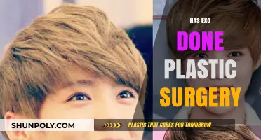 EXO Plastic Surgery Rumors: Fact-Checking the K-Pop Group's Transformation
