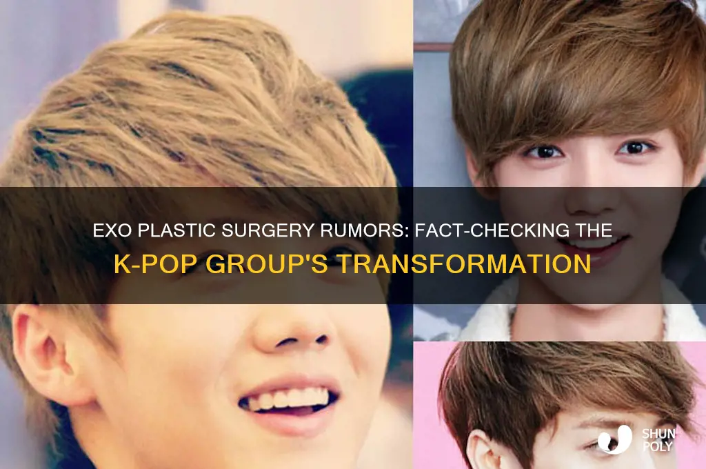 has exo done plastic surgery