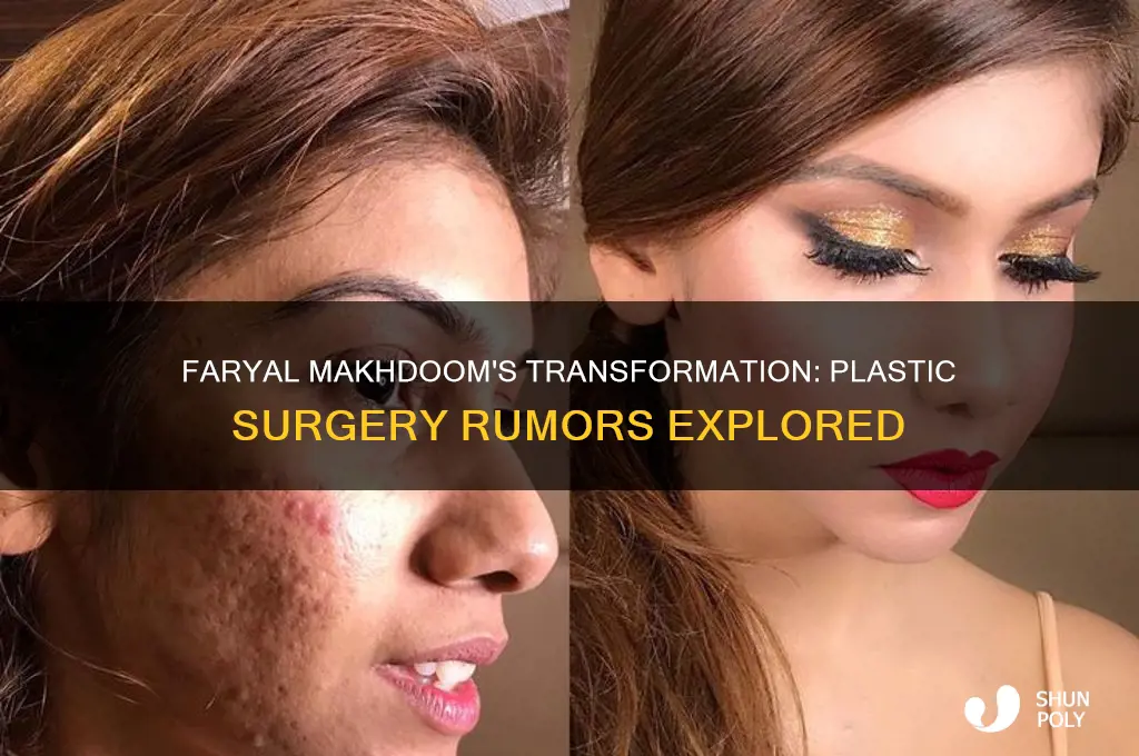 has faryal makhdoom done plastic surgery
