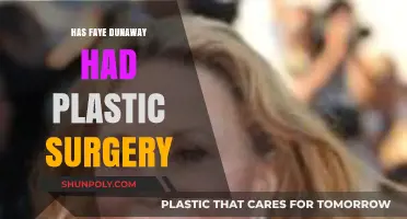 Faye Dunaway's Transformation: Plastic Surgery Speculations and Truths Revealed