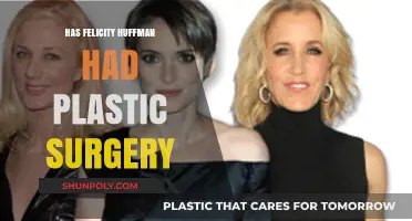 Felicity Huffman's Transformation: Plastic Surgery Rumors Explored