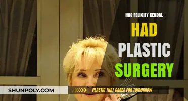 Felicity Kendal's Transformation: Plastic Surgery Speculations and Truths