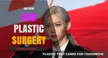 Has Felix Had Plastic Surgery? Uncovering the Truth Behind the Rumors