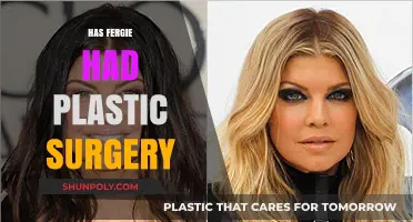 Fergie's Transformation: Plastic Surgery Rumors and the Truth Behind Them