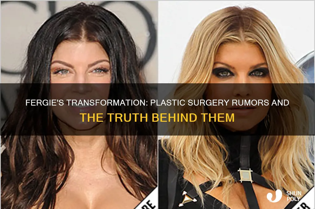 has fergie had plastic surgery